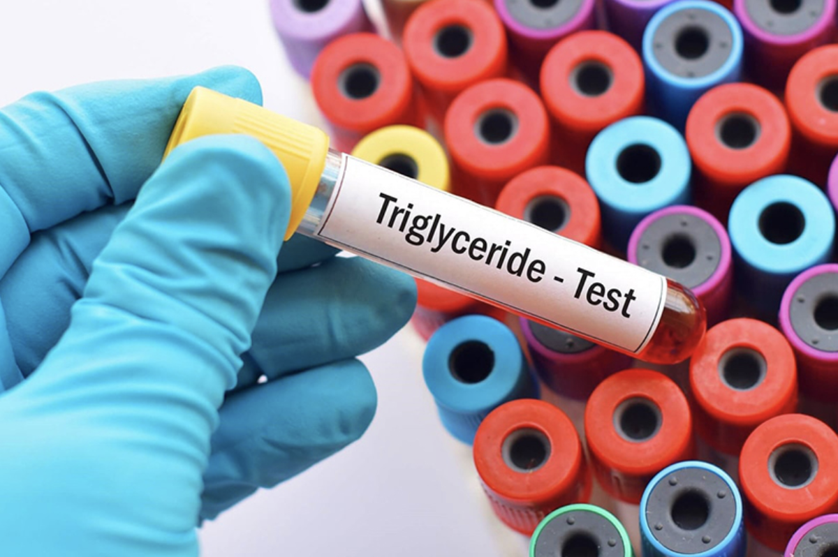 Chỉ số triglycerid cao làm tăng nguy cơ biến chứng