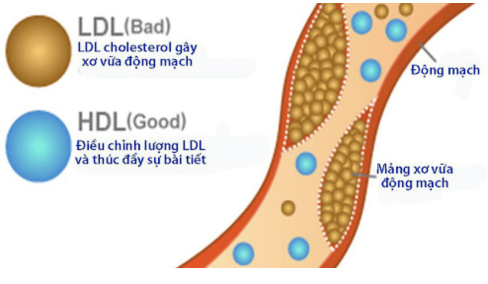 Tác dụng của HDL-c và LDL-c trong cơ thể