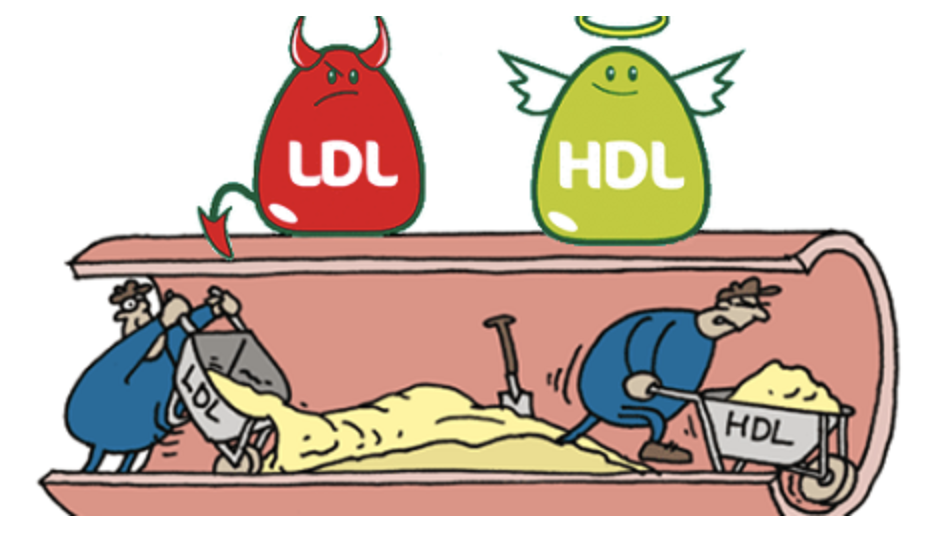 HDL-Cholesterol
