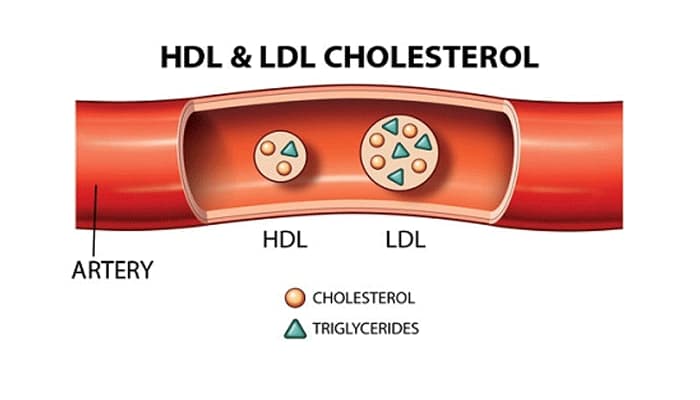Hàm lượng Cholesterol toàn phần máu được xác định bởi ba thành phần đó là HDL Cholesterol, LDL Cholesterol và Triglycerides.