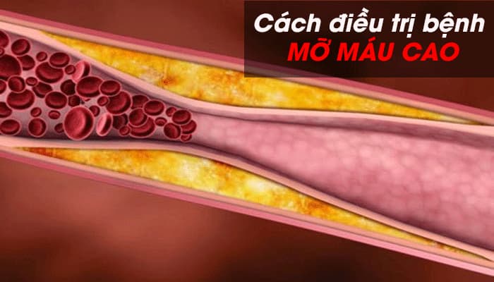 Điều trị máu nhiễm mỡ tại nhà 