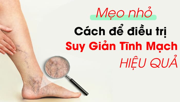 Một số mẹo hay sau đây bài viết sẽ chỉ cho bạn 