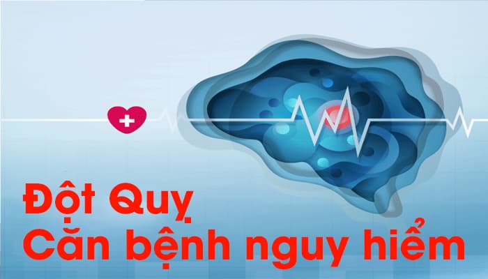 Đột quỵ (tai biến mạch máu não) là một tổn thương ở não sẽ xảy ra khi não không được cung cấp đủ lượng máu cần thiết để thực hiện các hoạt động sống.