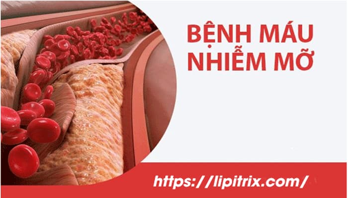 Máu nhiễm mỡ là tình trạng nồng độ chất béo trong máu cao hoặc thấp hơn mức bình thường