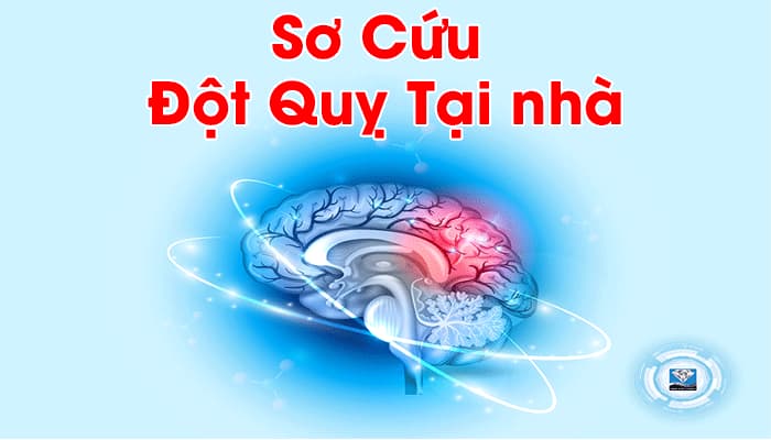 Sơ cứu đột quỵ ngay tại nhà tốt nhất