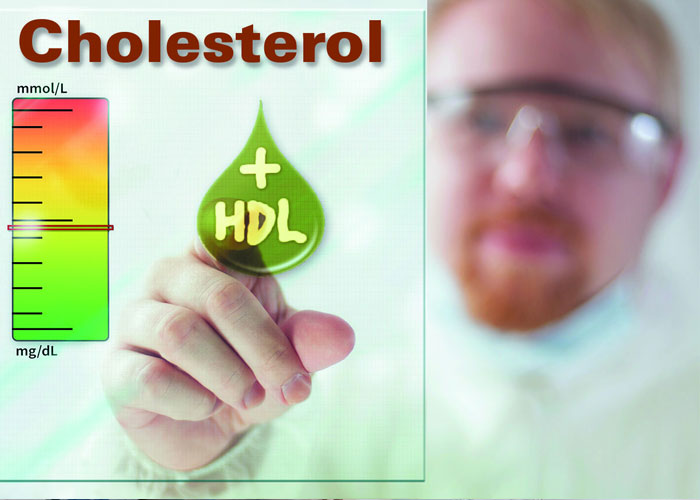 Mức cholesterol trong máu tăng thúc đẩy quá trình xơ vữa động mạch